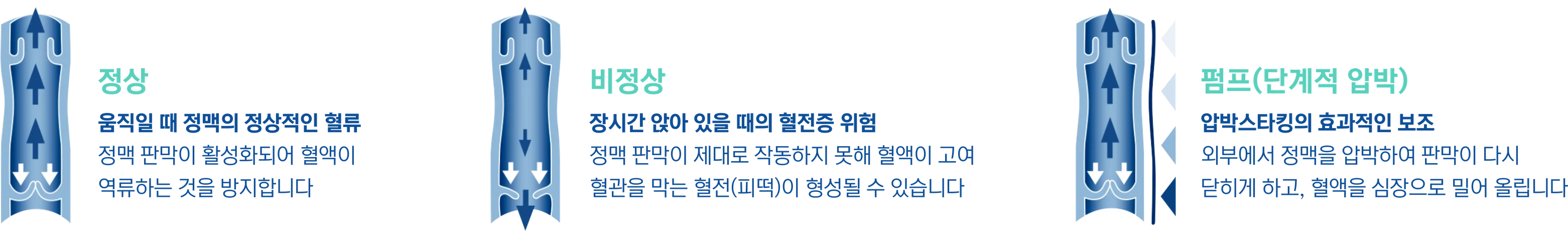 정상 · 비정상 · 펌프(단계적 압박) 정맥 판막 비교